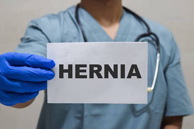 Latest Hernia Mesh Lawsuit Update: Are New Claims Still Being Filed?

